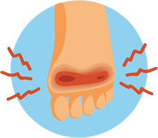 FOOT PAIN
